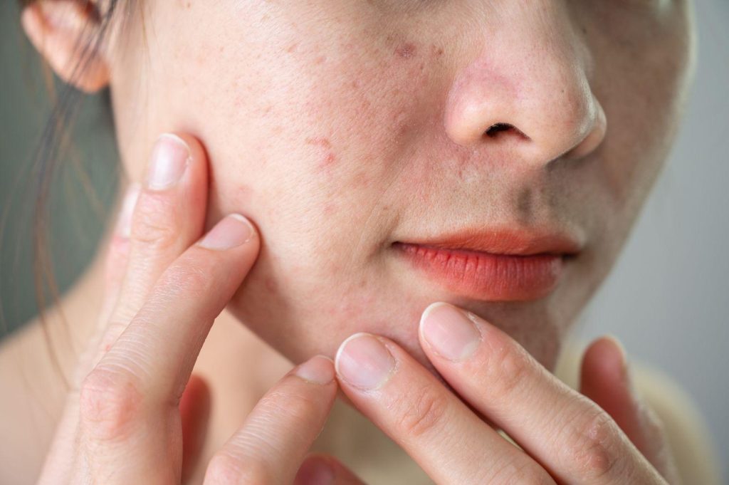 Ozempic's Hidden Costs: Hair, Skin, and Confidence
